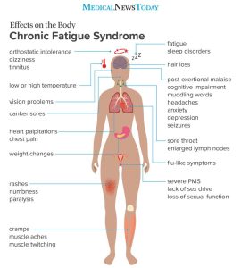 effects of chronic fatigue syndrome